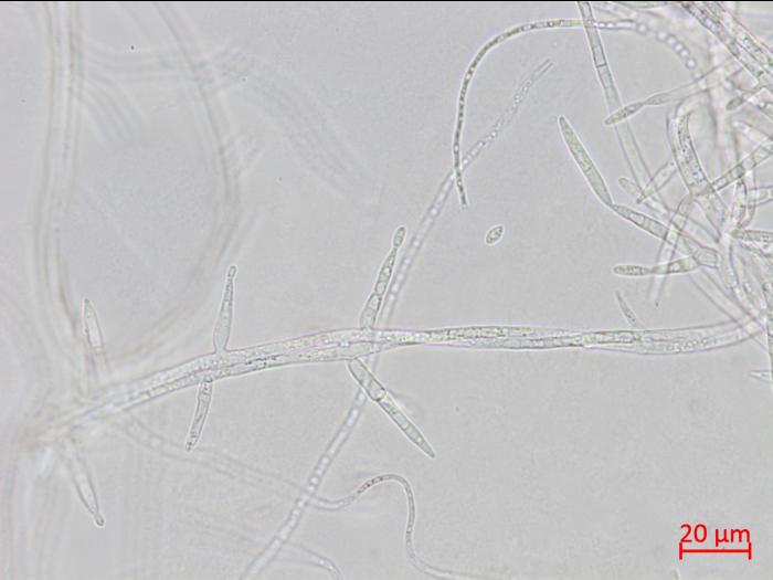Fusarium_proliferatum_3