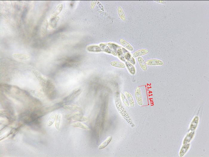 Glomerella_sp_1