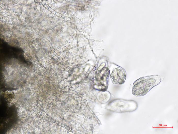 Leptosphaerulina_sp_2