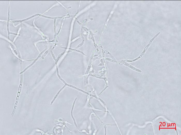 Microdochium_sp_1