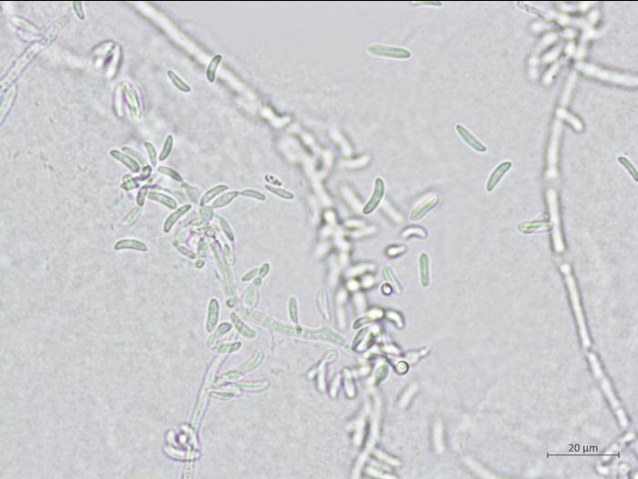 Microdochium_sp_4