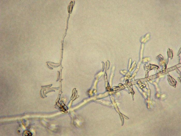 Fusarium_oxysporum_2