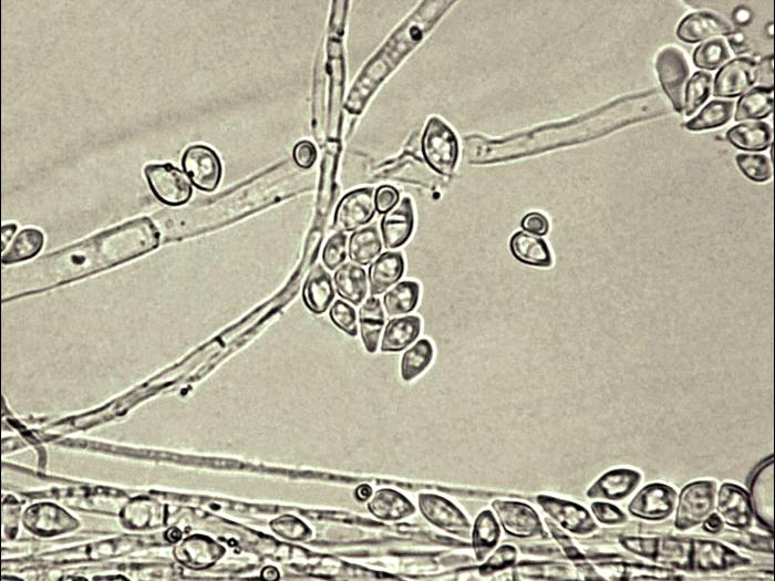 Fusarium_tricinctum_2