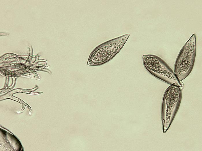 Peronospora_destructor_2