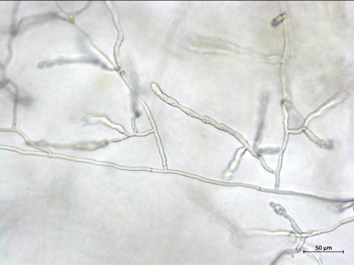 Rhizoctonia_sp_2