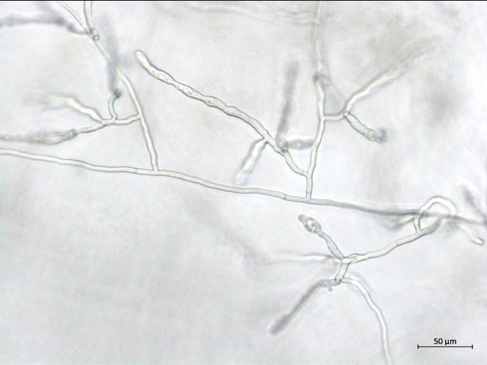 Rhizoctonia_sp_4