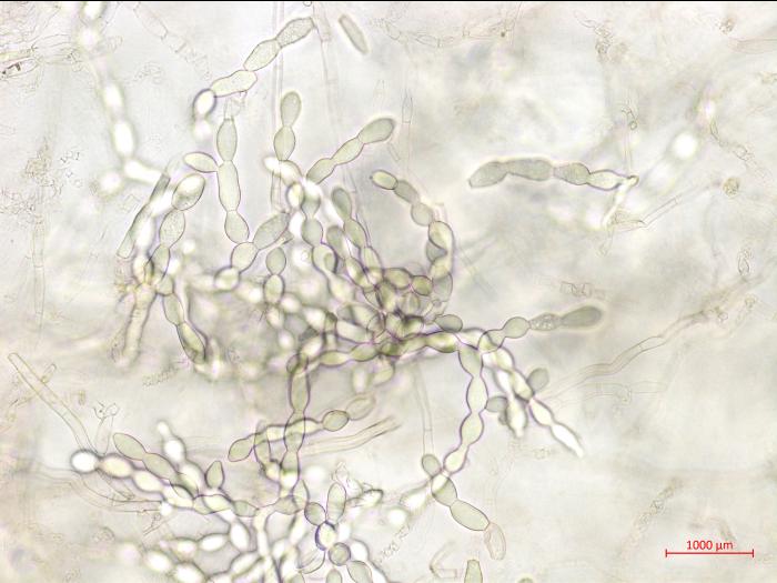 Rhizoctonia_solani_1