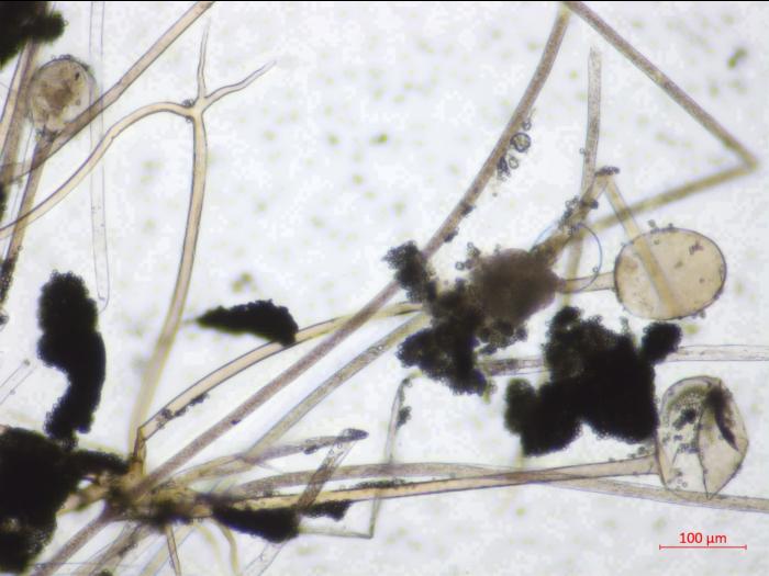 Rhizopus_sp_3