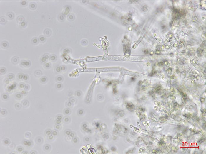 Trichoderma_virens_1
