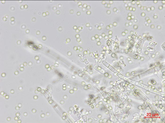Trichoderma_virens_2