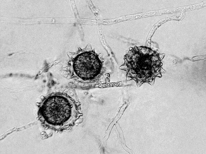 Pythium_polymastum_1