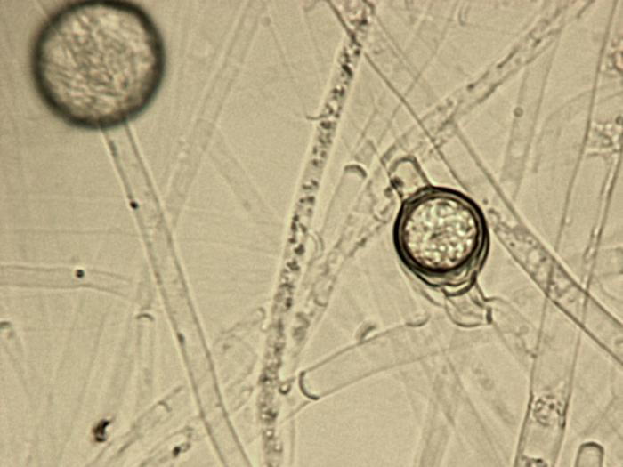 Pythium_ultimum_1