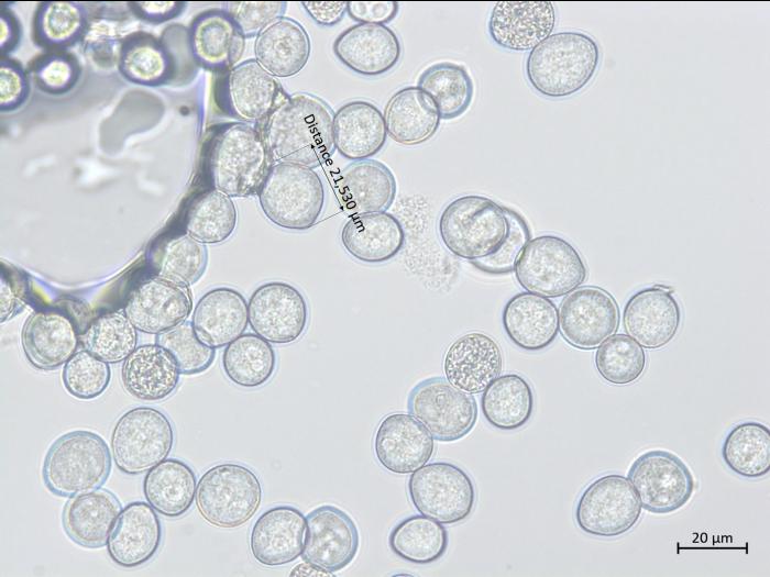 Albugo_candida_2