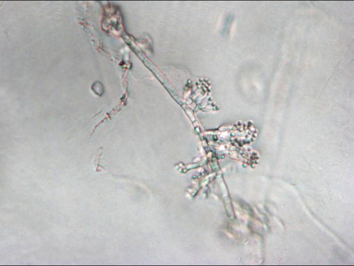 Sclerotium_cepivorum_3