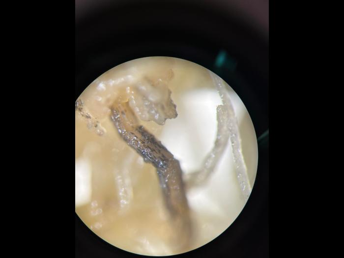 Berkeleyomyces_basicola_5