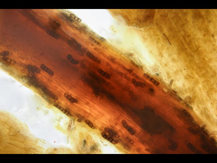 Berkeleyomyces_basicola_1