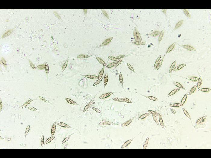 Alternaria_sp_4