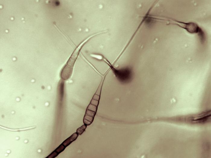 Alternaria_cichorii_5