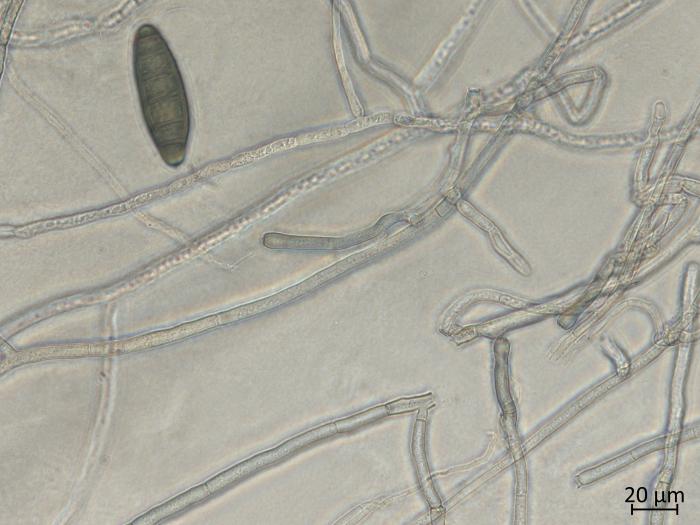 Bipolaris_sorokiniana_2