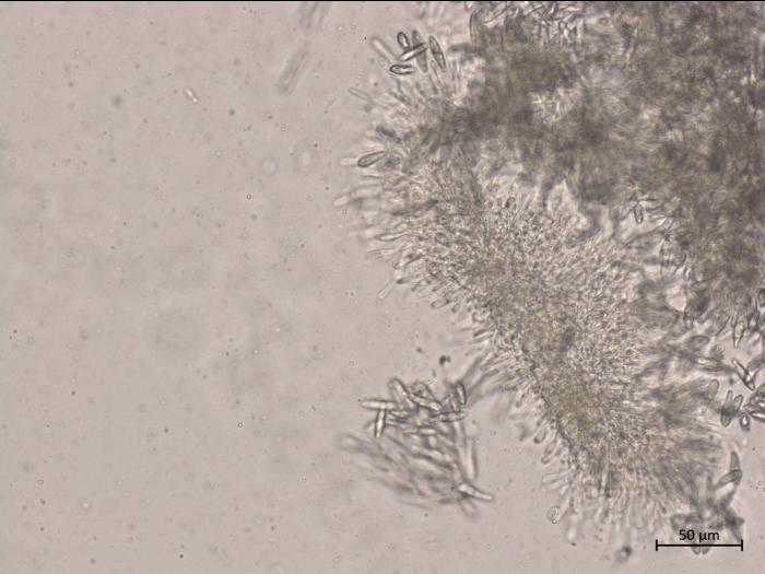 Botryosphaeria_dothidea_1