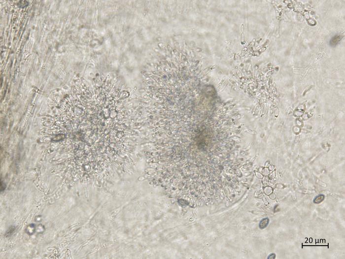 Coniella_diplodiella_5