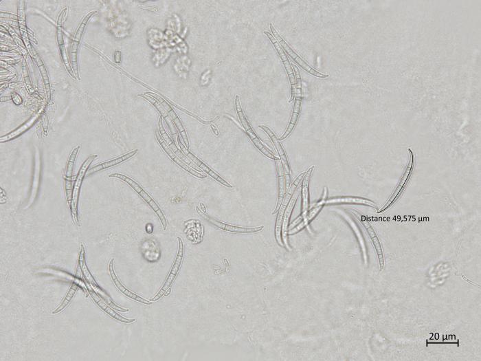 Fusarium_oxysporum_6