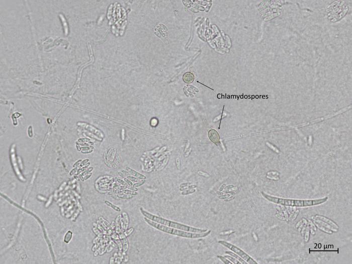 Fusarium_oxysporum_8
