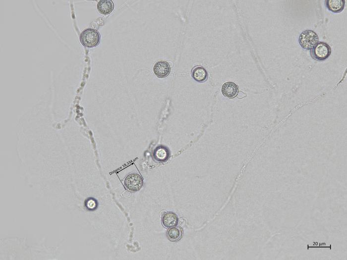 Globisporangium_irregulare_4