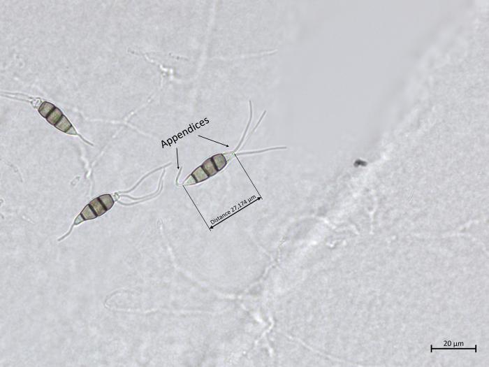 Neopestalotiopsis_sp_3