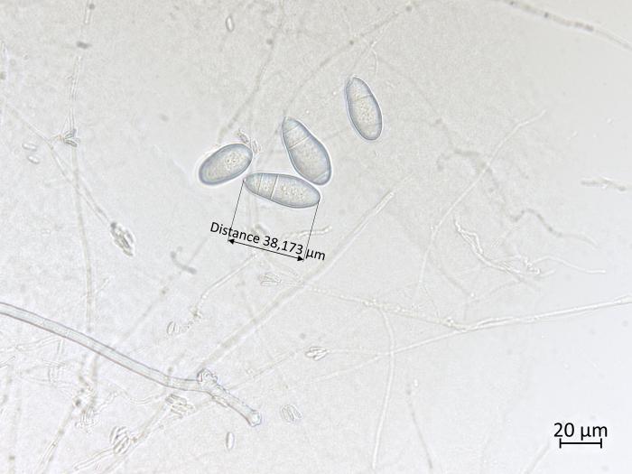 Orbilia_blumenaviensis_3