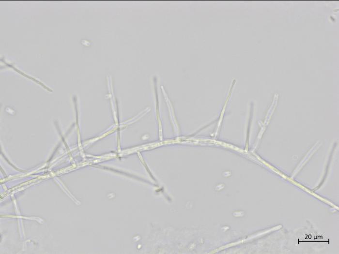 Sarocladium_strictum_1