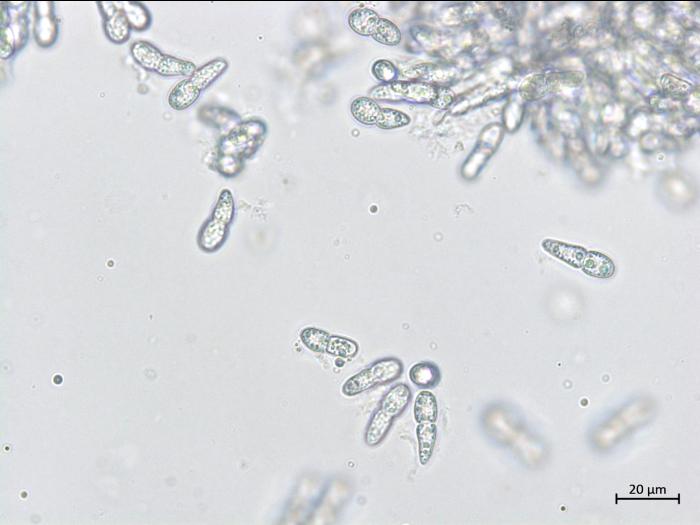 Diplocarpon coronariae