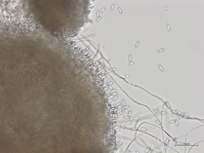 Colletotrichum_fioriniae_3