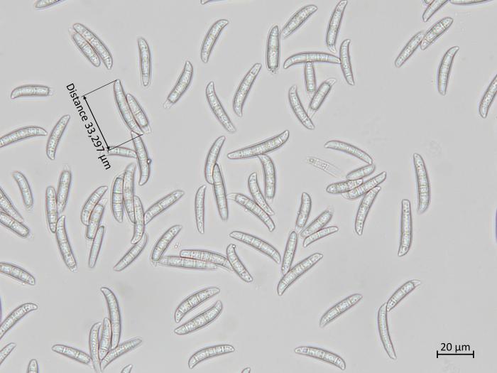 Fusarium_sambucinum_6