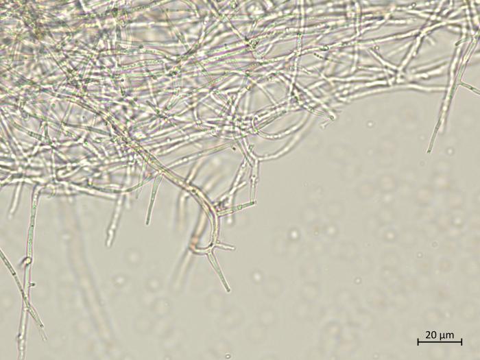 Phaeoacremonium_minimum_8