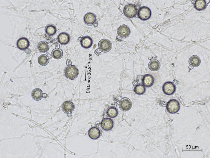 Phytophthora_erythroseptica_5
