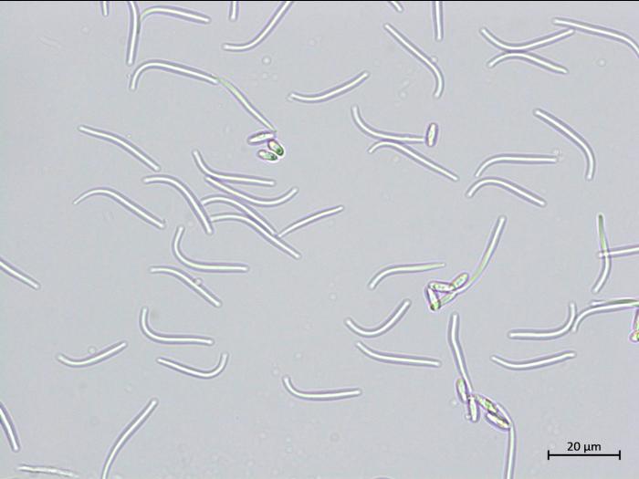 Diaporthe_sp_4