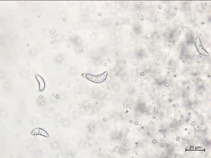 Drepanopeziza_ribis_3