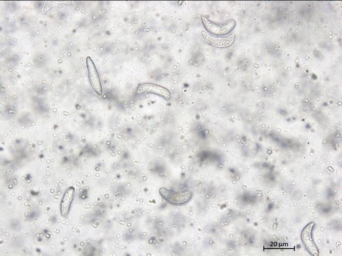 Drepanopeziza_ribis_4