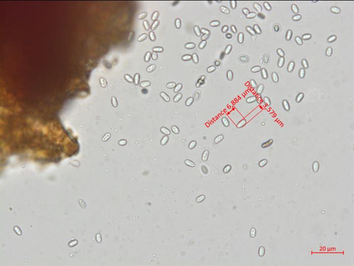 Elsinoe_ampelina_9