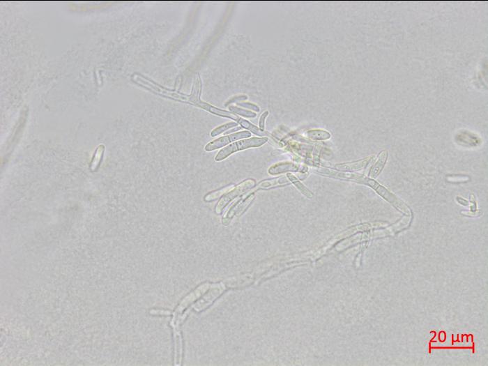 Fusarium_proliferatum_1