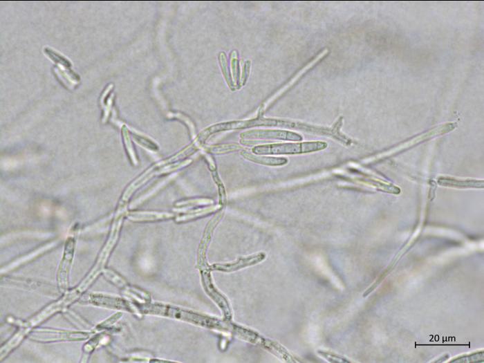 Fusarium_proliferatum_3
