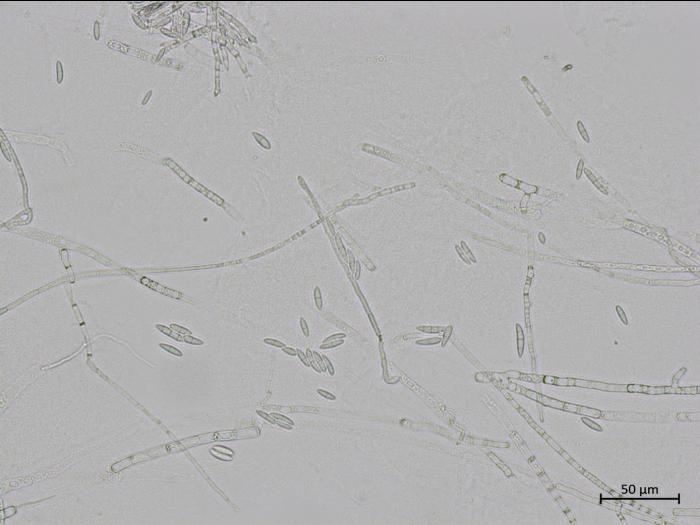 Fusarium_sporotrichioides_2