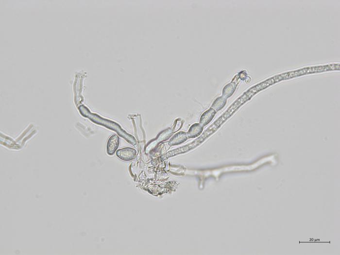 Monilinia_fructicola_1