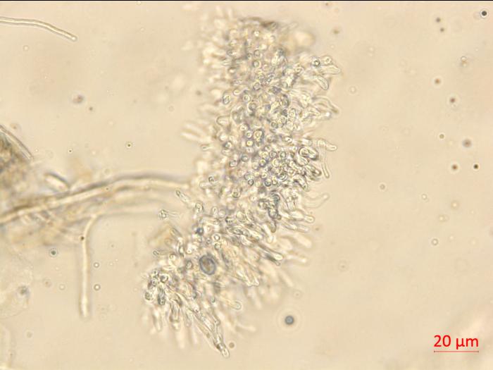 Neofusicoccum_parvum_6