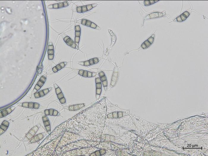 Neopestalotiopsis_clavispora_2