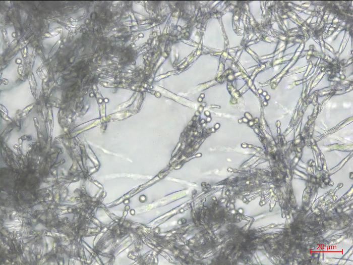 Penicillium_expansum_1