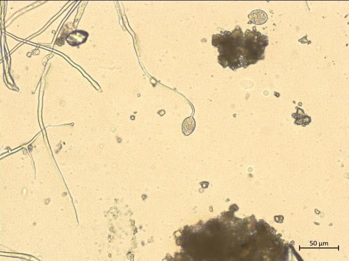 Phytophthora_infestans_1