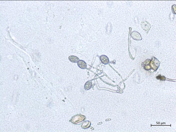 Phytophthora_infestans_4