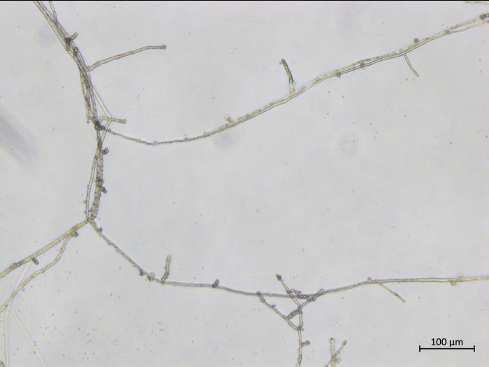 Phytophthora_nicotianae_1